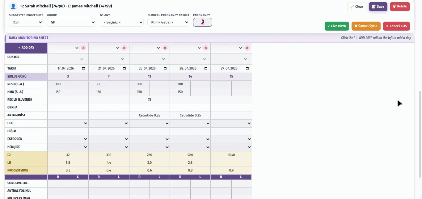 Daily ovarian stimulation monitoring sheet with per-day doses, hormone values and follicle counts